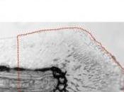 CICATRISATION: rôle protéine choc thermique Regenerative Medicine