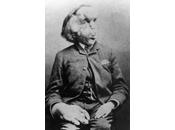 Joseph Merrick vrai apparence étrange…