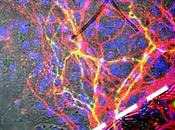 PARKINSON MICROBIOTE Quand l'alpha-synucléine voyage cerveau l'intestin Acta Neuropathologica