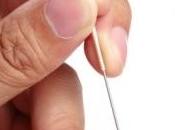 COLIQUE Quelle efficacité l'acupuncture Acupuncture Medicine