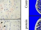 EXERCICE supplémentation L'irisine, elle brûle graisse renforce l'os Bone Research