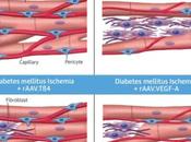 DIABÈTE perte capillaires sanguins explique risque crise cardiaque Journal American College Cardiology