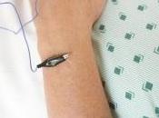 FIBROMYALGIE Comment l'électro-acupuncture cible soulage douleur Scientific Reports