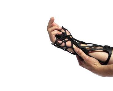 Ce plâtre imprimé en 3D va révolutionner le traitement des fractures