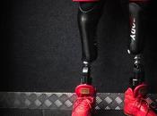 Amputé deux jambes, Edgard John-Augustin devenu Bionic Body
