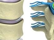 Infiltration foraminale pour soulager douleur l’hernie discale
