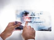 ÉROSION DENTAIRE nouveau matériau vient bout l’hypersensibilité dentinaire