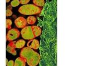 IST, INFERTILITÉ Mycoplasma genitalium, prochaine superbactérie