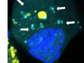 CANCER CERVEAU Injecter code génétique nanométrique pour réparer cellules