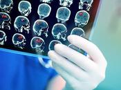 Comment réparer cerveau vision