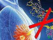 CANCER SEIN Découverte d’une co-vulnérabilité dans cellules cancéreuses