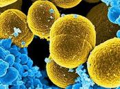MICROBIOME L’hyperperméabilité intestinale explique l’auto-immunité chez patients séropositifs