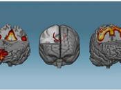 NEUROFEEDBACK rien temps, peut changer cerveau