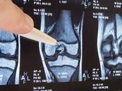 ARTHROSE GENOU thérapie cellulaire répare cartilage