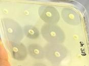 ANTIBIORÉSISTANCE Dans hôpitaux français, elle coûte millions d’euros