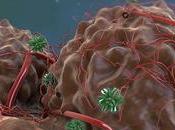 CANCER plaie chronique jamais
