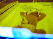 ICTÈRE nouveau-né règle Bili pour dépister l'hyperbilirubinémie néonatale