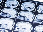 RISQUE SUICIDE Peut-on détecter dans cerveau