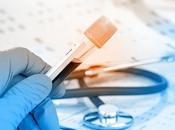 ALZHEIMER flotilline, nouveau marqueur diagnostique sérique