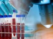 ALZHEIMER test sanguin analysé l'IA prédit neurodégénérescence