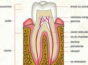 L’hypersensibilité dentaire