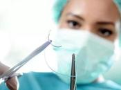 Suturer plaie méthodes délai retrait points suture
