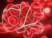 COVID-19 Risque élevé thrombose veineuse profonde