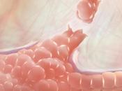 CANCER SEIN poumons utilisent respiration pour contrer colonisation