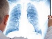 POLLUTION, DIABÈTE MALADIE PULMONAIRE faute l'ozone