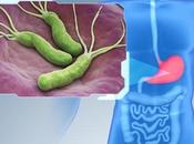 CANCERS GASTRIQUES Comment bactéries cancérigènes trouvent leurs victimes