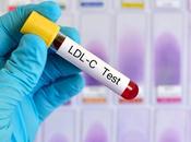 CHOLESTÉROL Est-ce bien meilleur marqueur risque cardiovasculaire