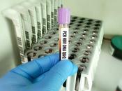HÉPATITE L’immunothérapie préserve doublement foie