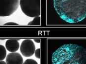SYNDROME RETT Découverte mécanisme génétique sous-jacent