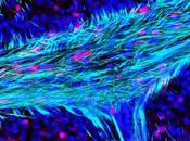 CHOLESTÉROL métabolisme, mécanisme pour cerveau