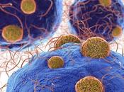 LUPUS globules rouges survoltés