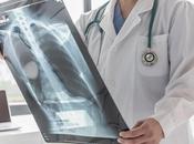 MUCOVISCIDOSE trithérapie efficace sûre même pour formes rares