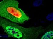 ALZHEIMER DAXX chaperon garant repliement protéines