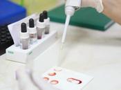 ALZHEIMER L’espoir d’un vaccin contre maladie