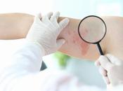 INFECTIONS CUTANÉES Pousser suicide cellules infectées