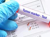 CANCER PROSTATE Pour dépistage ciblé fonction risque patient
