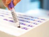ALZHEIMER Vers nouvelle thérapeutique