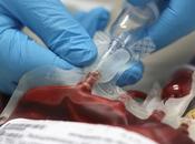 ALZHEIMER L’option l’échange total sang