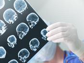 PARKINSON nanocorps démêlent amas d’alpha-synucléine