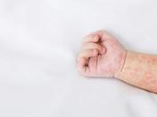 ECZÉMA médicament finit soulager bébés