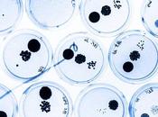 CRISE CARDIAQUE réparation cellules souches élimine tout risque d’arythmie