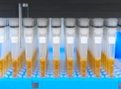 ALZHEIMER peptide pourrait prévenir neurodégénérescence